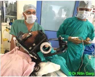 Neurosurgeon in Bhopal